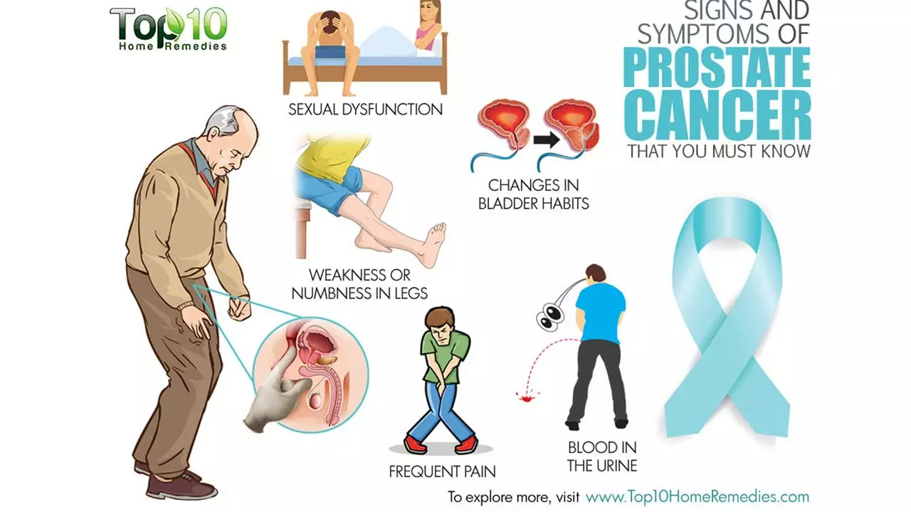 Flutamide and Prostate Cancer: Debunking Common Myths and Misconceptions